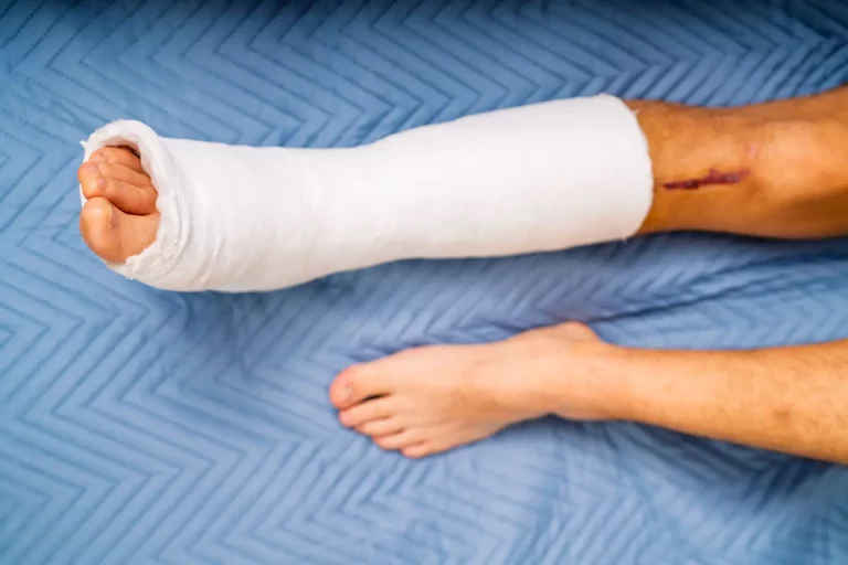 What Damages Can You Claim in a Personal Injury Case?